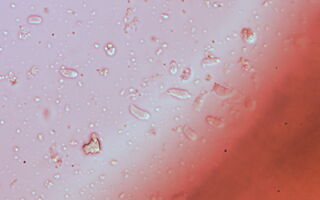 Dacryopinax martinii image